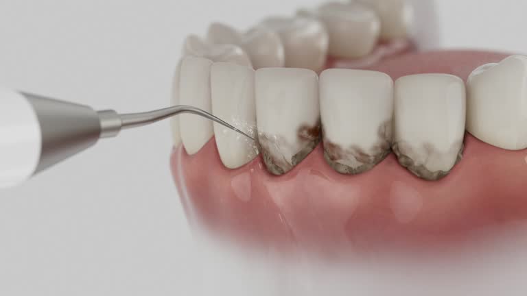 Reliable Dental Implants contractor in Poughkeepsie, NY by Smile Center Dentistry